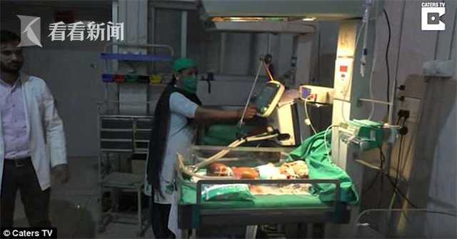 罕见鱼鳞病婴儿,印度塑料婴儿