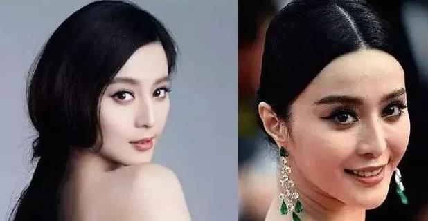 鐗涘ザ鑲岄潰鑶滄湁鍝簺,绱ц嚧鐗涘ザ鑲岀殑闈㈣啘