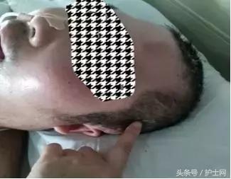 开颅手术患者怎么洗头发,开颅病人怎么洗头