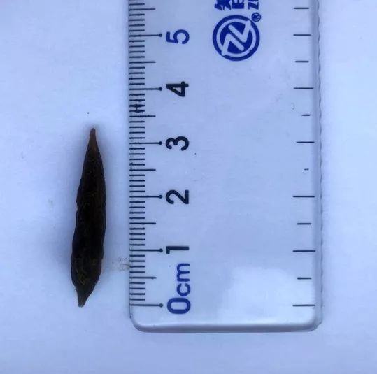 误吞了枣核咋办,误吞枣核怎么办