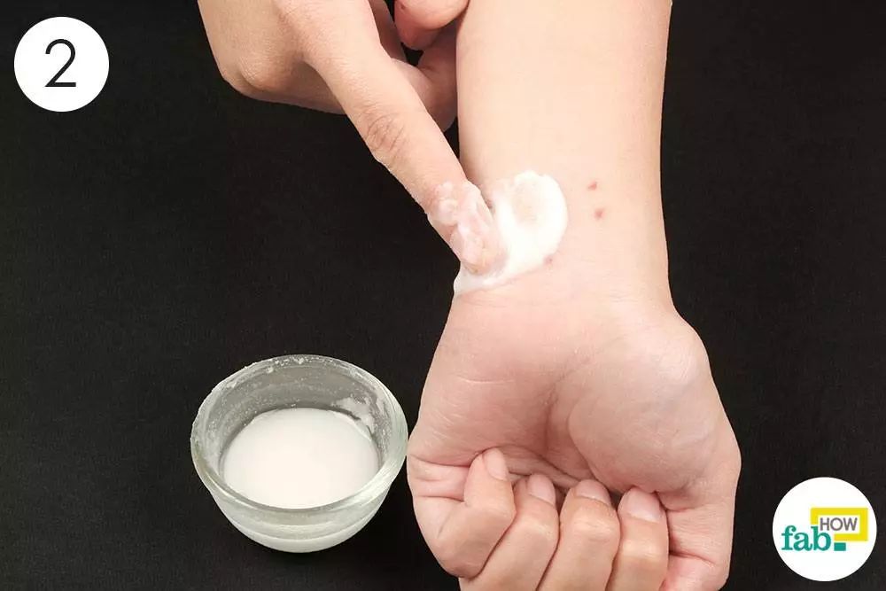 使用！总被蚊子咬？涂点这个马上止痒