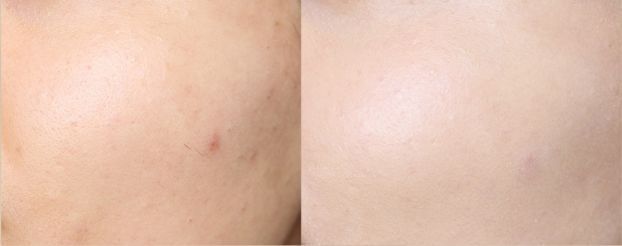 戚薇改版,戚薇变脸抖音