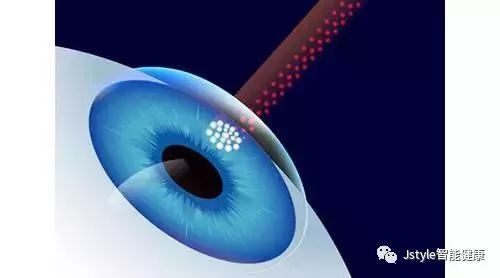 爱眼日｜最全的眼睛护理，哪些护眼方法最靠谱