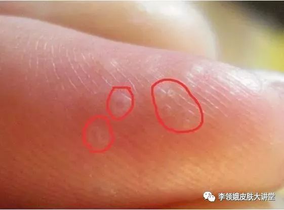 杏林微科普帮您认识各类头晕,杏林微科普最新消息