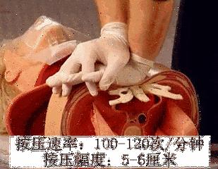 紧急！株洲一美女跑步后突然倒地，口吐白沫，四肢抽搐！