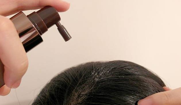 怀孕期间掉头发厉害怎么办,怀孕期间掉头发怎么办