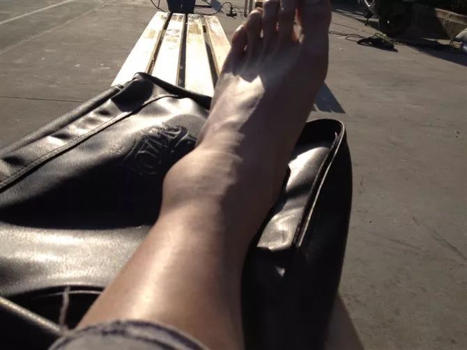 经常性崴脚恢复练习,崴脚后怎么恢复训练