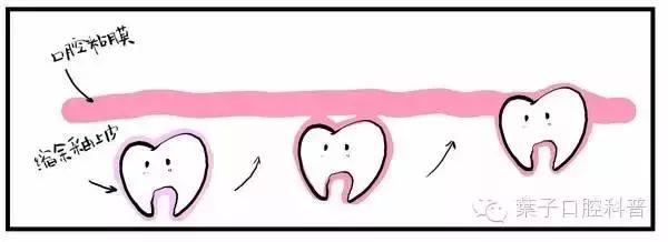儿童治疗牙齿科普动画,孩子牙齿成长全过程
