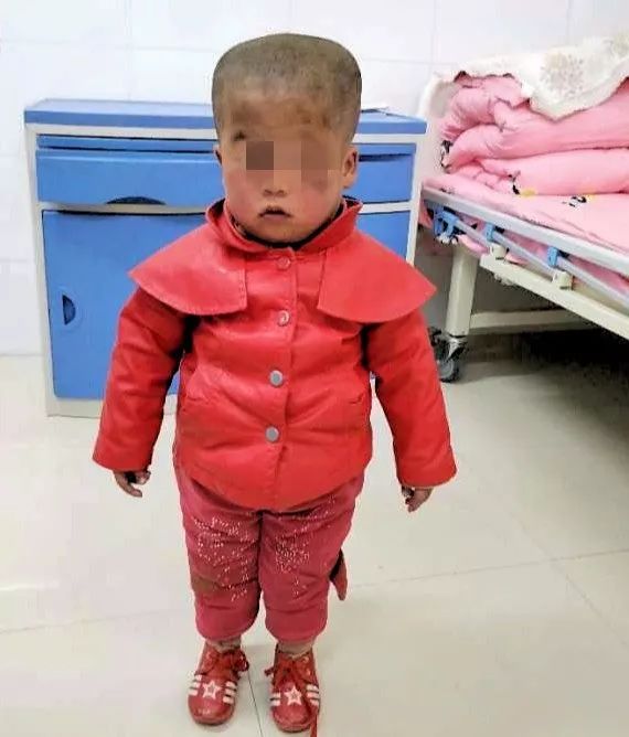 爱撒南疆热土深汗滴墨玉永恒情王文杰医生援疆三个月了