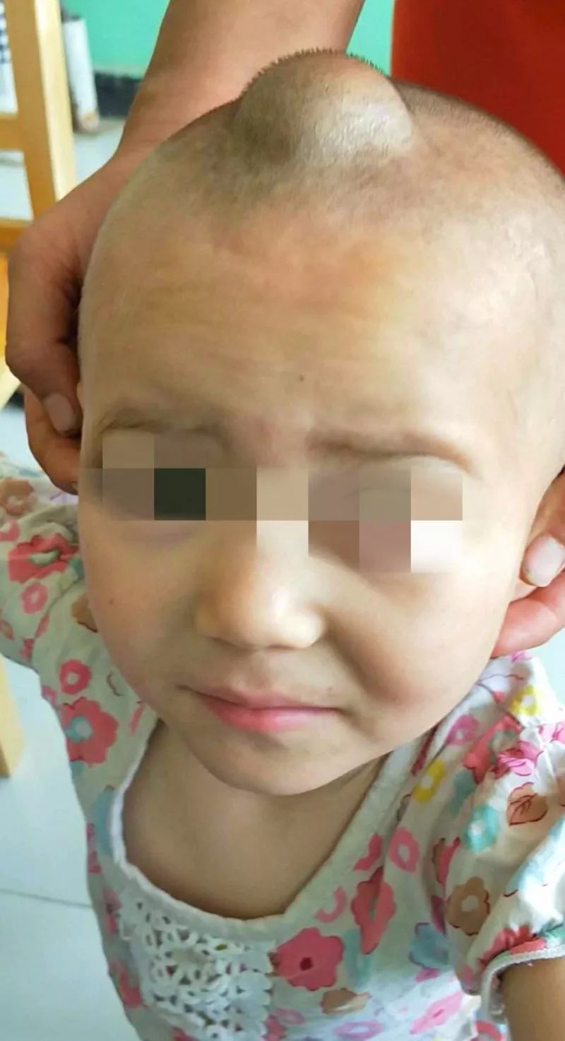 爱撒南疆热土深汗滴墨玉永恒情王文杰医生援疆三个月了