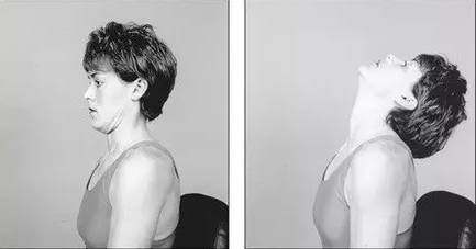 颈椎病麦肯基疗法基本动作,颈椎病的麦肯锡疗法