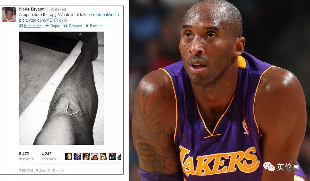 哈里梅根婚前求助中医！歪果仁已经把针灸吹上了天