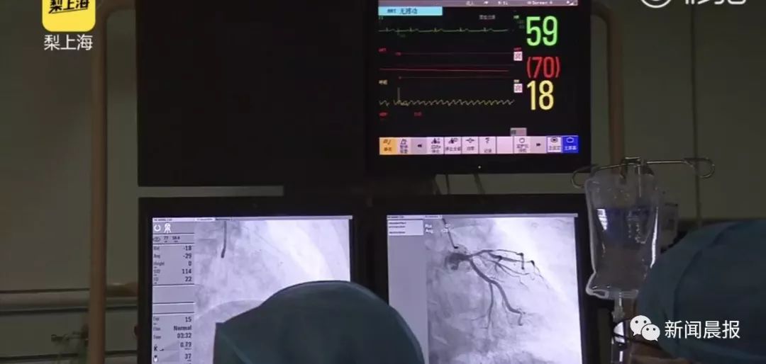 世界“悲”！39岁球迷连续熬夜看球至凌晨，一觉醒来差点……你还敢熬吗？