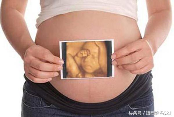 33周胎盘钙化能撑多久,胎盘钙化和孕期缺钙有关系吗