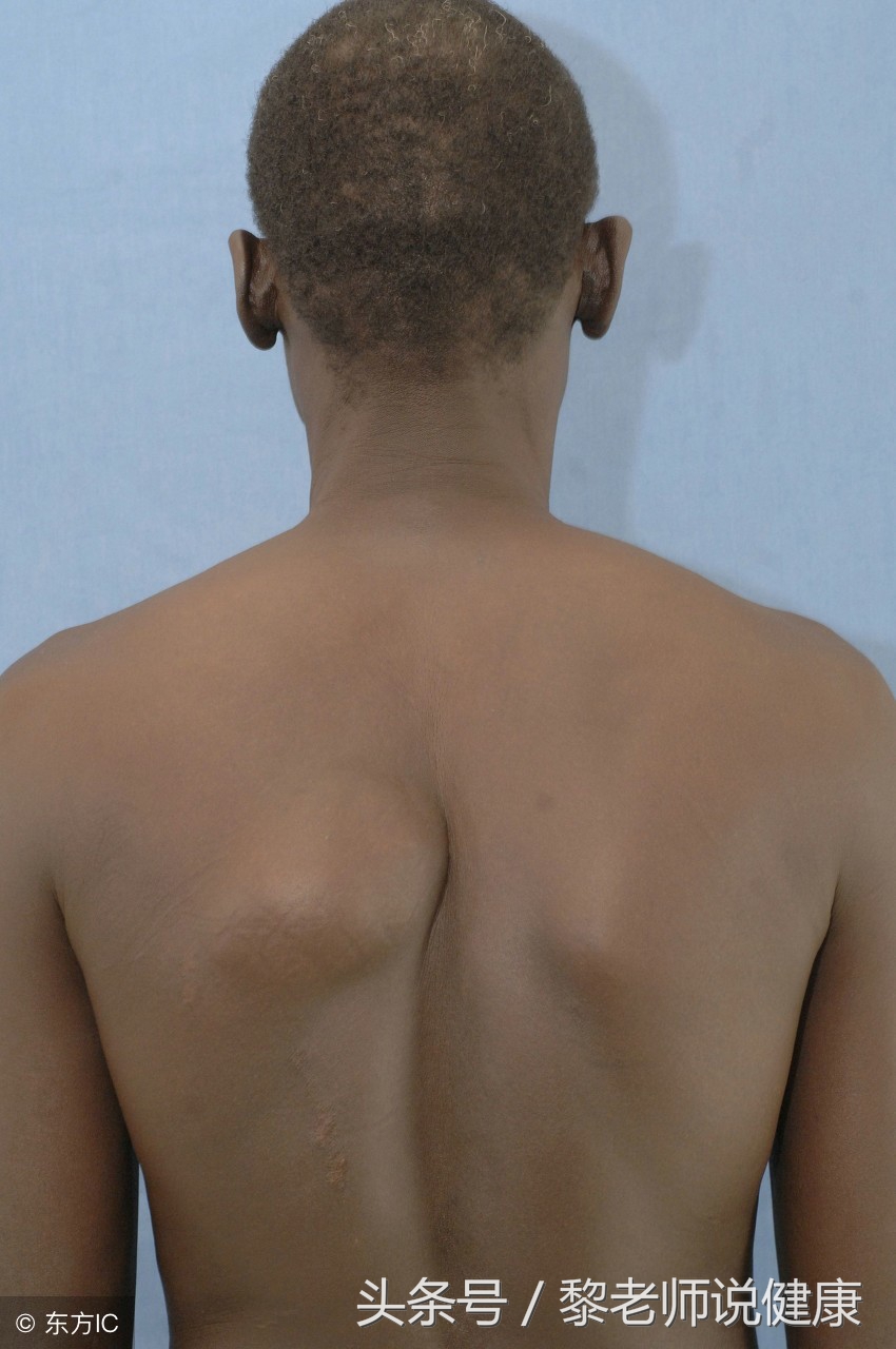 酸性食物能消除脂肪吗,酸性体质多吃面食管用吗