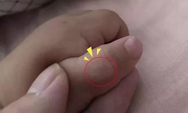 戒吃手神器管用吧,戒吃手的办法