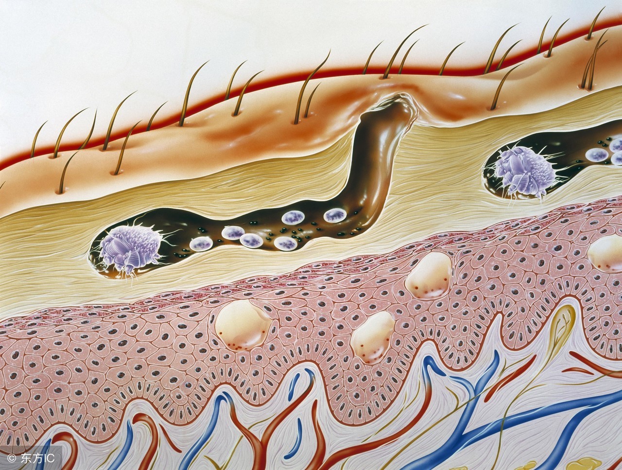 每次睡醒后身上起疙瘩,睡觉起床后身上长很痒的红疙瘩