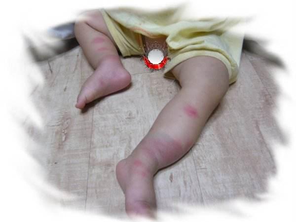 婴儿防蚊叮咬的小妙招,宝宝老是被蚊虫咬有什么驱蚊方法