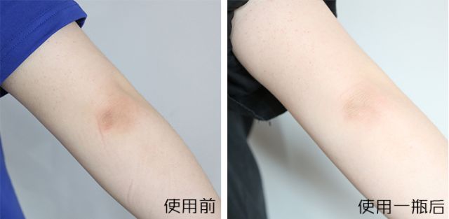 告别小尴尬~日本女*爱性**用好物,抹一抹4周白嫩如少女!