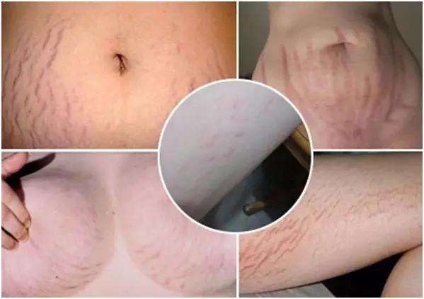 嘉兰蒂娜美容护肤,嘉兰蒂娜