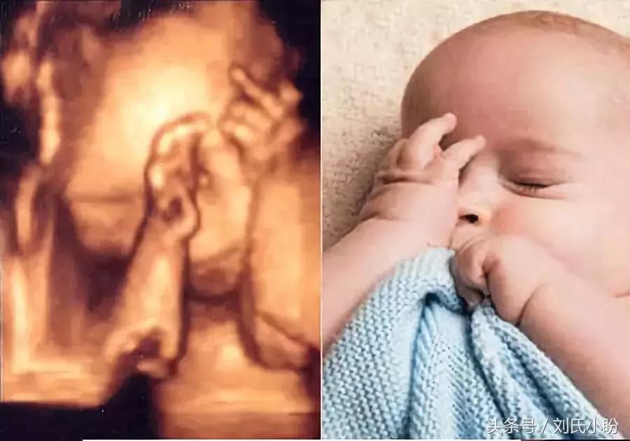 宝宝在肚子里胎动是怎样的,胎动时宝宝在肚子里做什么呀