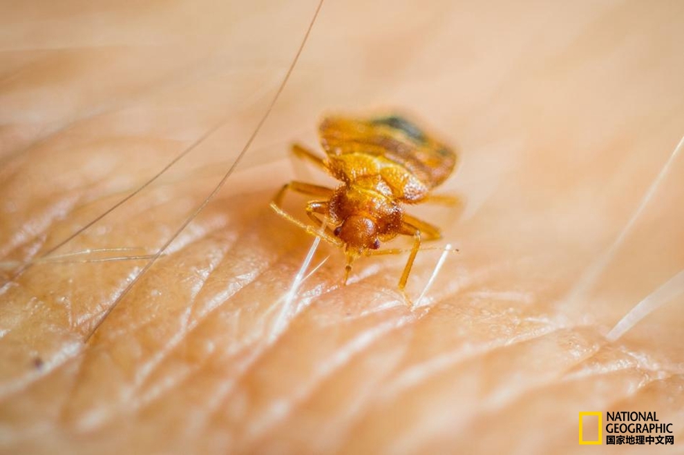 为啥人身体里有虫,总觉得自己体内有虫