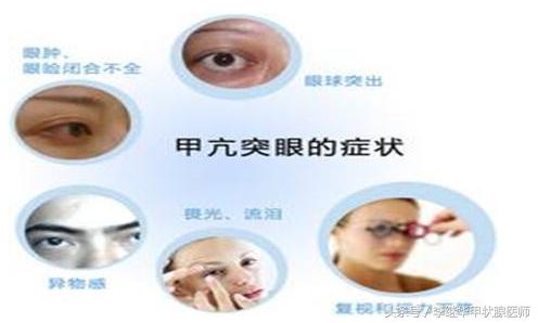 两大招教你消除甲亢眼浮肿！
