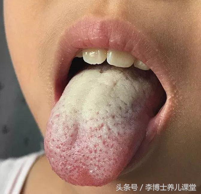 为什么宝宝出汗特别多,为什么宝宝满头汗