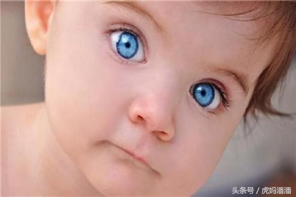 宝宝有眼屎可以喝什么降火,上火导致的宝宝眼屎多怎么办