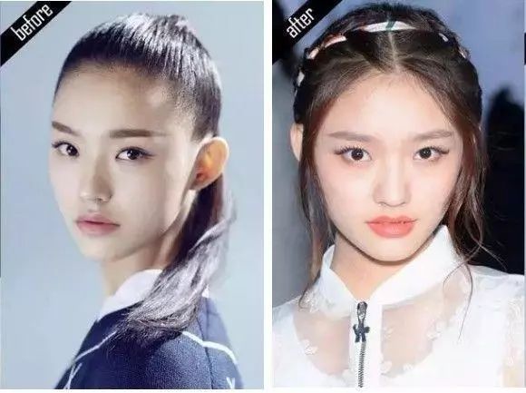 发际线太高显老这些神器了解一下,发际线不好看自己怎么弄