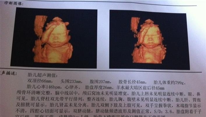 产检费用再贵，从怀孕到“卸货”，这几个检查项目都必不可少！