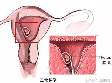 与时间赛跑成功抢救心梗患者,宫外孕大出血死里逃生捡回一命