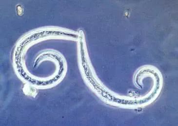 寄生虫危害预防控制措施,寄生虫病有哪些症状和预防的方法