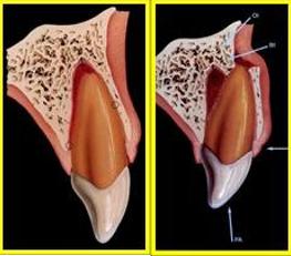 怎么拯救牙齿最快最有效,如何拯救牙齿