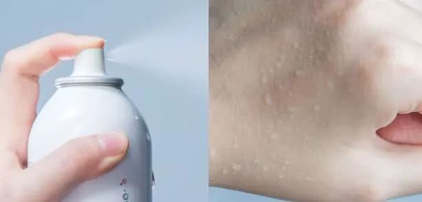 夏天喷雾保湿补水神器测评,夏天脸部补水保湿喷雾