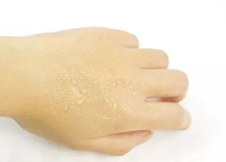 夏天喷雾保湿补水神器测评,夏天脸部补水保湿喷雾