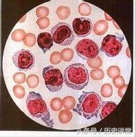 谁才是药神原版,谁是药神陆勇