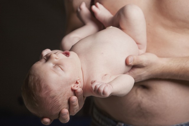 两个月宝宝头上长红疙瘩怎么回事,两个多月的宝宝头顶有红疹子