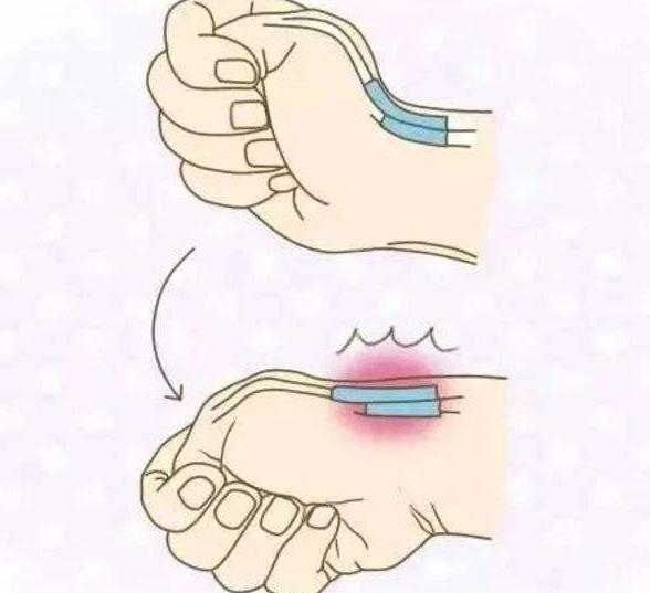 腱鞘囊肿涂腱鞘炎药膏有什么用,腱鞘炎和腱鞘囊肿哪个更严重一点