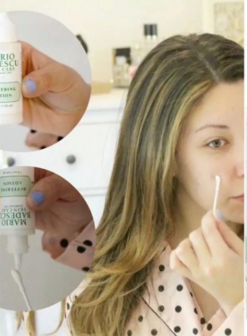 亲试十大祛痘药,亲测各类祛痘印护肤品