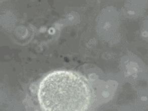 一直以为自己是跑得最快的那颗精子,原来并不是……