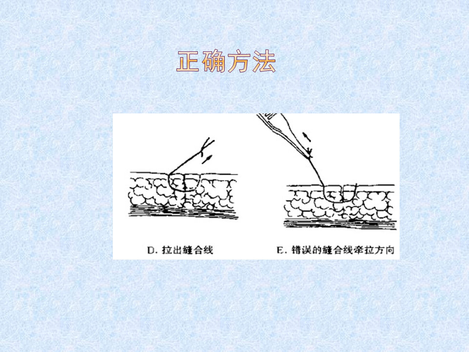 换药和拆线操作流程视频,换药拆线操作视频