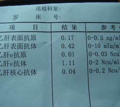 肝病医生带你看肝功能化验单