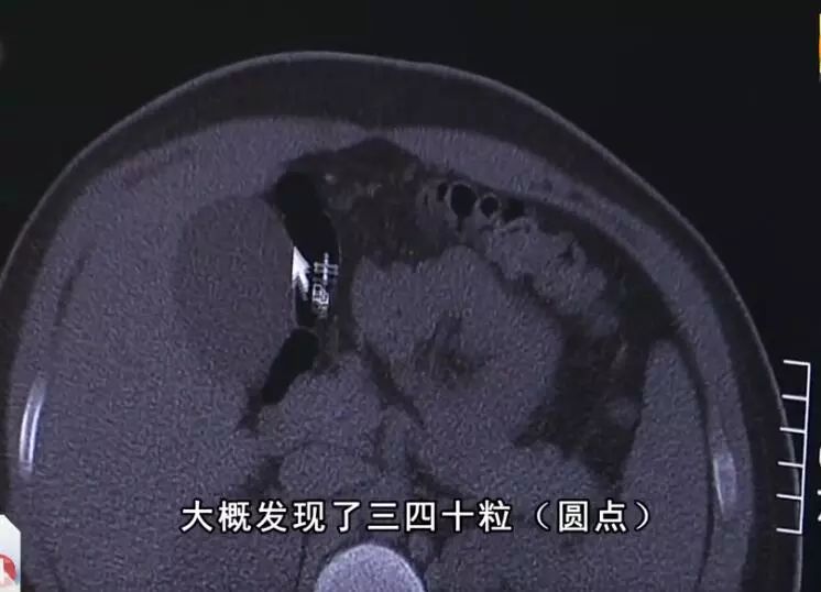 男孩喝珍珠奶茶呛喉死亡,男生喝珍珠奶茶因呛到气管身亡