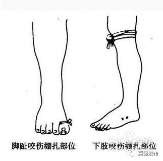 广东英德蛇咬伤人事件,广州英德最近被蛇咬事件