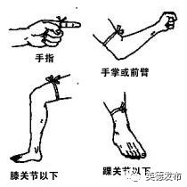 广东英德蛇咬伤人事件,广州英德最近被蛇咬事件