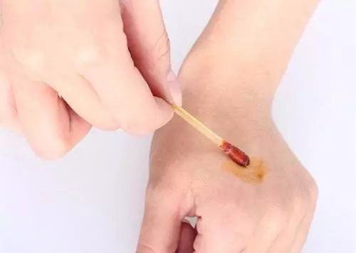 创可贴贴住的伤口更难愈合,晚上睡觉伤口贴创可贴好还是不贴