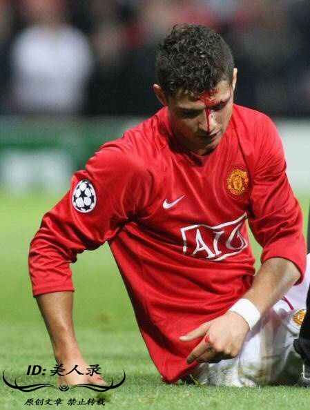 c罗被打满脸是血是哪一次,眼角被撞出血了一定要缝针么