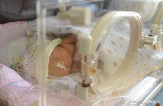 宝宝有黄疸怎么办用什么方法,宝宝黄疸怎么办方法竟然如此简单