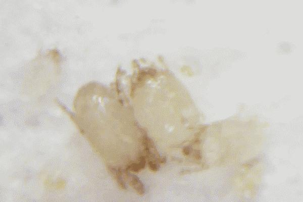 除螨喷雾除被子上的螨虫有效果吗,被子有螨虫不洗怎样去螨